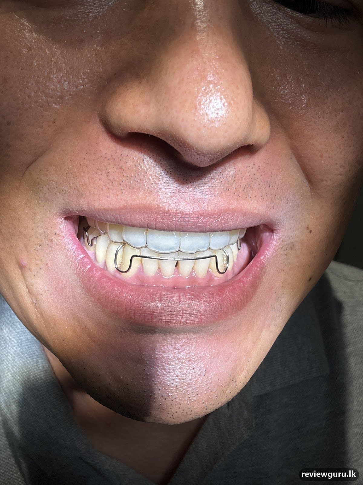 Colombo Dental Clinic Pamankada
