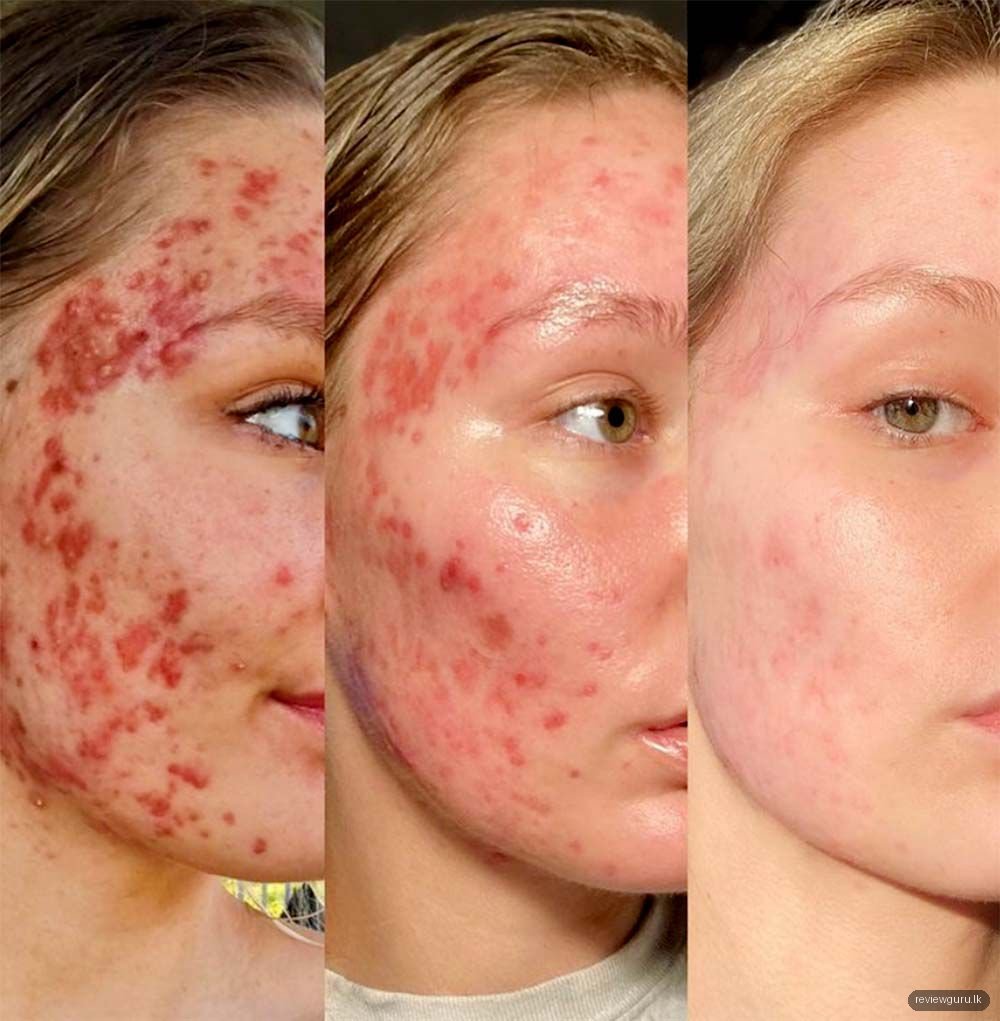 Araliya SkinCare Kandy