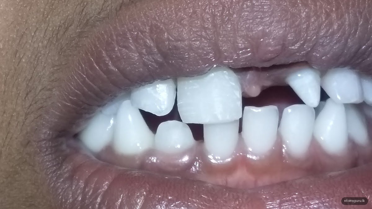 Brighter Smile Cosmetic Dental Clinic