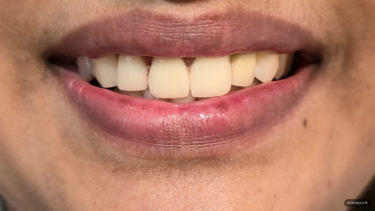 Dentcare Dental (Dr. Shaminda Wimalasena & Dr.Chathurika Wimalasena )