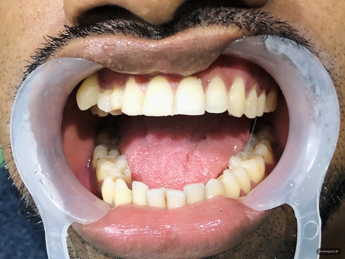 Dr. Indira Widanagamachchi - Kingswaththa Dental Clinic