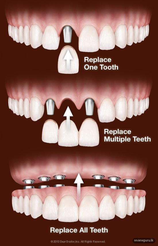 Jaffna dental clinic Dr.Purushothaman's