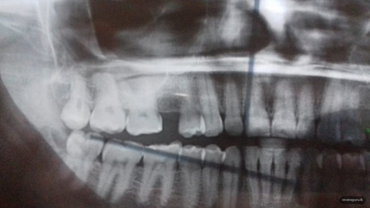 New Ideal Dental Clinic - PVT LTD