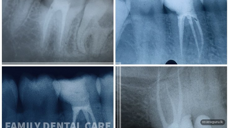 The Family Dental Care, Nallur